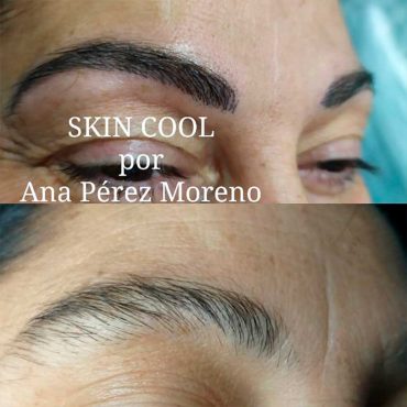 MICROPIGMENTACIÓN DE CEJAS